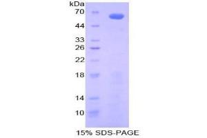 SDS-PAGE analysis of Mouse Insulin Like Growth Factor Binding Protein 2 (IGFBP2) Protein. (IGFBP2 蛋白)
