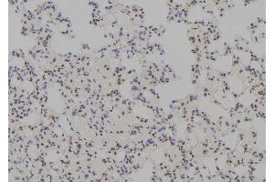 ABIN6278744 at 1/100 staining Rat lung tissue by IHC-P. (TTF1 抗体  (Internal Region))