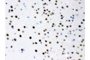 IHC testing of FFPE mouse brain with MEF2A antibody. (MEF2A 抗体)