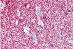 Human Brain, cortex: Formalin-Fixed, Paraffin-Embedded (FFPE) (Cnpase 抗体  (AA 122-352))