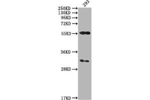 Western Blot Positive WB detected in: 293 whole cell lysate All lanes: CAMK2A antibody at 1:2000 Secondary Goat polyclonal to rabbit IgG at 1/50000 dilution Predicted band size: 55, 56 kDa Observed band size: 55 kDa (CAMK2A 抗体  (AA 321-478))