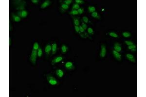 Immunofluorescent analysis of Hela cells using ABIN7169889 at dilution of 1:100 and Alexa Fluor 488-congugated AffiniPure Goat Anti-Rabbit IgG(H+L) (SUMO3 抗体  (AA 1-92))