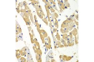 Immunohistochemistry of paraffin-embedded mouse heart using HNMT antibody (ABIN6292124) at dilution of 1:100 (40x lens). (HNMT 抗体)