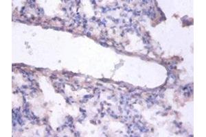 Immunohistochemistry of paraffin-embedded human lung tissue using ABIN7151790 at dilution of 1:100 (ERH 抗体  (AA 2-104))
