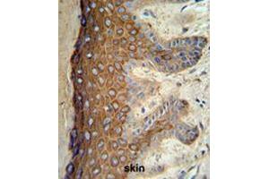 KRT1 Antibody (Center) IHC analysis in formalin fixed and paraffin embedded skin tissue followed by peroxidase conjugation of the secondary antibody and DAB staining. (Cytokeratin 1 抗体  (Middle Region))