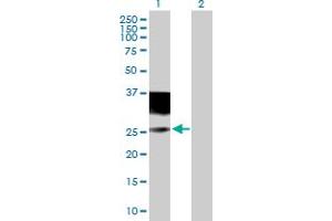 Western Blot analysis of IL4R expression in transfected 293T cell line by IL4R MaxPab polyclonal antibody. (IL4 Receptor 抗体  (AA 1-227))