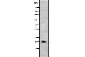 Western blot analysis IL26 using COS7 whole cell lysates