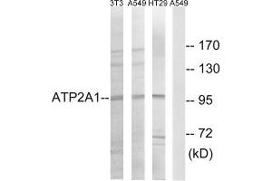 Western blot analysis of extracts from NIH/3T3 cells, A549 cells and HT-29 cells, using ATP2A1 antibody. (ATP2A1/SERCA1 抗体  (Internal Region))