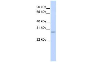 WB Suggested Anti-VASH1 Antibody Titration: 0. (VASH1 抗体  (N-Term))