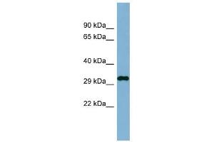 C20ORF116 antibody used at 1 ug/ml to detect target protein. (DDRGK1 抗体  (N-Term))