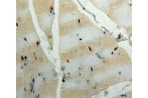 Used in DAB staining on fromalin fixed paraffin-embedded muscle tissue (CA3 抗体  (AA 27-217))
