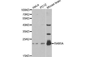 Western blot analysis of extracts of various cell lines, using RAB5A antibody. (RAB5 抗体)