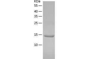 Cystatin S (CST4) (AA 21-141) protein (His-IF2DI Tag)