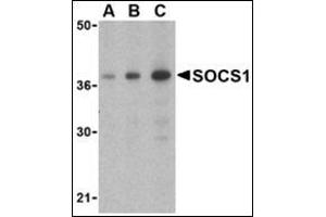 Western blot analysis of SOCS1 in Human spleen cell lysate with this product at (A) 1, (B) 2 and (C) 4 μg/ml. (SOCS1 抗体  (C-Term))