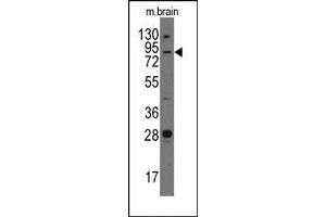Image no. 1 for anti-Junctophilin 3 (JPH3) (Middle Region) antibody (ABIN357848) (Junctophilin 3 抗体  (Middle Region))