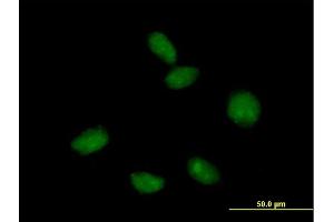 Immunofluorescence of purified MaxPab antibody to FLJ10292 on HeLa cell.
