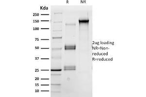 SDS-PAGE (SDS) image for anti-POU domain, class 2, transcription factor 2 (POU2F2) (AA 112-297) antibody (ABIN6940359)
