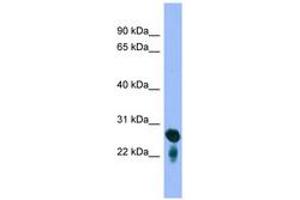 Image no. 1 for anti-RAB5C, Member RAS Oncogene Family (Rab5c) (C-Term) antibody (ABIN6745664) (Rab5c 抗体  (C-Term))