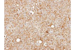 IHC-P Image Immunohistochemical analysis of paraffin-embedded SW480 xenograft, using MCCC2, antibody at 1:100 dilution. (MCCC2 抗体  (Center))