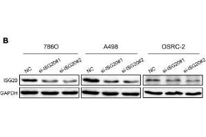 ISG20 promoted ccRCC cell proliferation in vitro. (GAPDH 抗体)