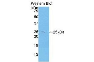 Western Blotting (WB) image for anti-Desmocollin 1 (DSC1) (AA 486-686) antibody (ABIN1858667) (Desmocollin 1 抗体  (AA 486-686))
