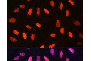 Immunofluorescence analysis of U-2 OS cells using DiMethyl-Histone H3-K14 Polyclonal Antibody at dilution of 1:100 (40x lens). (Histone 3 抗体  (2meLys14))