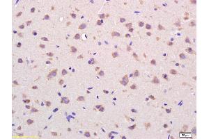 Formalin-fixed and paraffin embedded rat brain labeled with Rabbit Anti VDAC Polyclonal Antibody, Unconjugated (ABIN686872) at 1:200 followed by conjugation to the secondary antibody and DAB staining (VDAC1 抗体  (AA 85-190))
