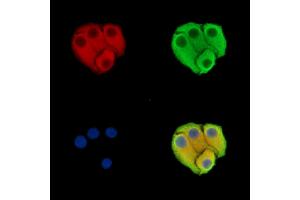 ABIN7096488 and ABIN7100552 staining Hela cells by IF/ICC.