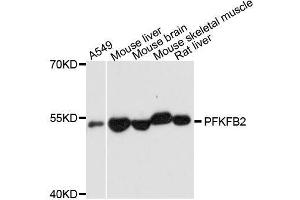 Western blot analysis of extracts of various cell lines, using PFKFB2 antibody. (PFKFB2 抗体  (AA 446-505))