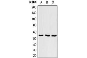 Western blot analysis of SFRS11 expression in NCI-H292 (A), SP2/0 (B), H9C2 (C) whole cell lysates. (SRSF11 抗体  (Center))