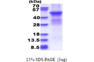 SDS-PAGE (SDS) image for Protein Kinase, CAMP Dependent, Catalytic, beta (PRKACB) (AA 1-398) protein (His tag) (ABIN5853686) (PRKACB Protein (AA 1-398) (His tag))