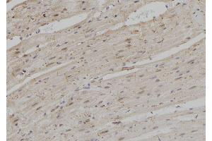 ABIN6279037 at 1/100 staining Rat heart tissue by IHC-P. (RPS3A 抗体  (C-Term))