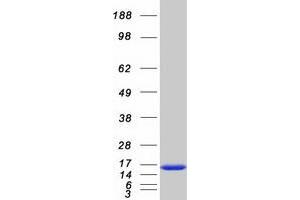 Western Blotting (WB) image for Cystatin B (Stefin B) (CSTB) protein (Myc-DYKDDDDK Tag) (ABIN2712792)