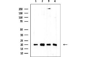 anti-RPL26L (RPL26L) (C-Term) antibody