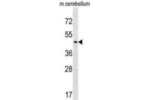 Western Blotting (WB) image for anti-Carbohydrate (N-Acetylglucosamine-6-O) Sulfotransferase 2 (CHST2) antibody (ABIN3000842) (CHST2 抗体)