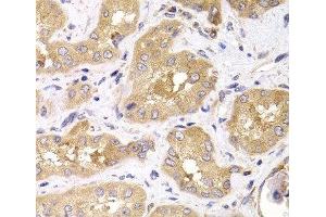 Immunohistochemistry of paraffin-embedded Human kidney using RPS4X Polyclonal Antibody at dilution of 1:100 (40x lens). (RPS4X 抗体)