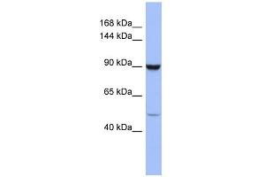 WB Suggested Anti-ZFP28 Antibody Titration:  0. (ZFP28 抗体  (Middle Region))
