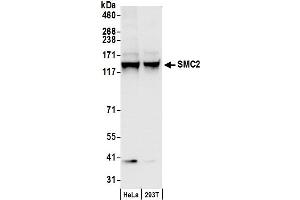 anti-Structural Maintenance of Chromosomes 2 (SMC2) (C-Term) antibody