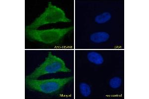 ABIN185659 Immunofluorescence analysis of paraformaldehyde fixed HeLa cells, permeabilized with 0. (Hsc70 抗体  (Internal Region))