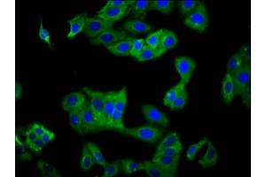 Immunofluorescence staining of HepG2 cells with ABIN7157520 at 1:100, counter-stained with DAPI. (KIR2DS5 抗体  (AA 162-242))