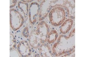 Used in DAB staining on fromalin fixed paraffin- embedded kidney tissue (TRAPPC10 抗体  (AA 74-357))