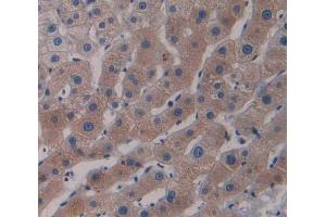 Used in DAB staining on fromalin fixed paraffin- embedded Kidney tissue (RND1 抗体  (AA 1-229))