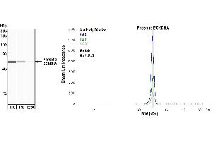 Western Blotting (WB) image for anti-Branched Chain Keto Acid Dehydrogenase E1, alpha Polypeptide (BCKDHA) (pSer292) antibody (ABIN7449282) (Recombinant BCKDHA 抗体  (pSer292))