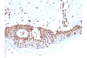 Immunohistochemistry (IHC) image for anti-Mismatch Repair Protein 2 (MSH2) (AA 327-427) antibody (ABIN6940081)