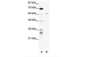 Image no. 1 for anti-IKAROS Family Zinc Finger 4 (Eos) (IKZF4) (AA 97-146) antibody (ABIN202738) (IKZF4 抗体  (AA 97-146))