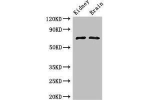 Western Blot Positive WB detected in: Mouse kidney tissue, Mouse brain tissue All lanes: GAA Antibody at 3 μg/mL Secondary Goat polyclonal to rabbit IgG at 1/50000 dilution Predicted band size: 70, 76, 106 kDa Observed band size: 70 kDa (GAA 抗体  (AA 601-952))