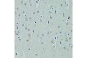 Immunohistochemistry of paraffin-embedded rat brain using ZNF346 antibody (ABIN5975303) at dilution of 1/100 (40x lens). (ZNF346 抗体)