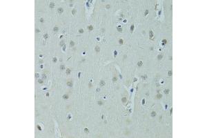 Immunohistochemistry of paraffin-embedded rat brain using ZNF346 antibody (ABIN5975303) at dilution of 1/100 (40x lens). (ZNF346 抗体)