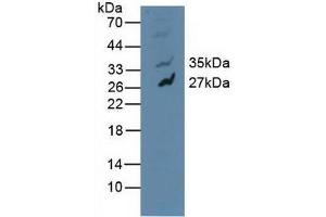 Detection of MAPK10 in Human U-87MG Cells using Polyclonal Antibody to Mitogen Activated Protein Kinase 10 (MAPK10) (MAPK10 抗体  (AA 88-332))