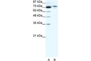 WB Suggested Anti-C14ORF101 Antibody Titration:  0. (C14orf101 抗体  (N-Term))